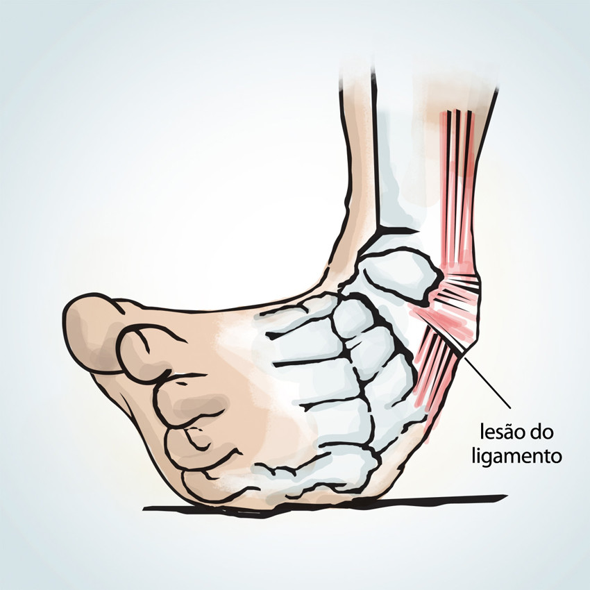 lesao tornozelo